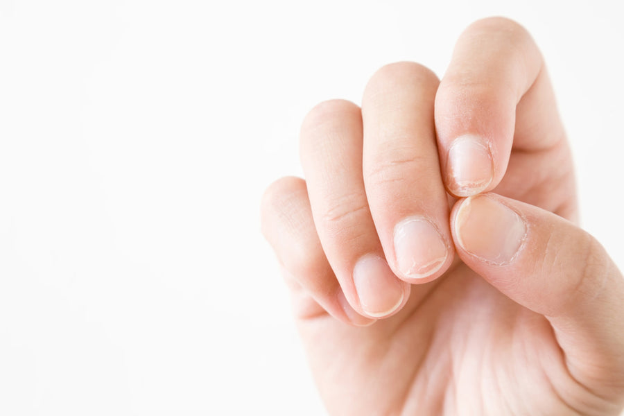 10 Tips To Treat Brittle Nails